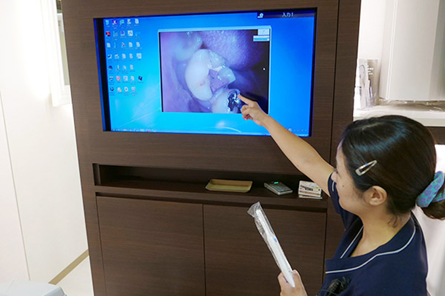 位歯科用CCDカメラ