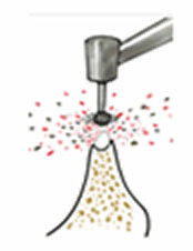 従来のインプラント