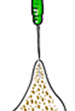 OAMインプラント