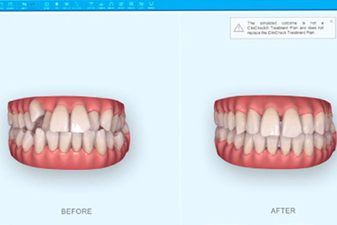 どのように治るかを事前にイメージ