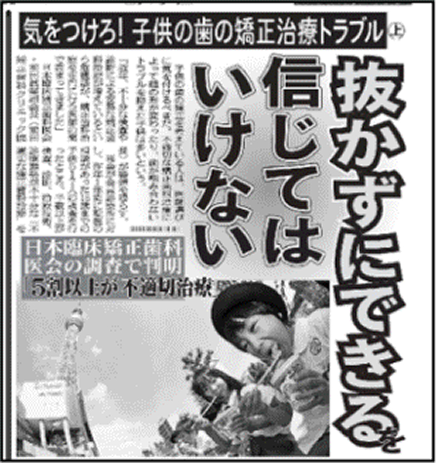 矯正治療には早期治療と青年期治療があります