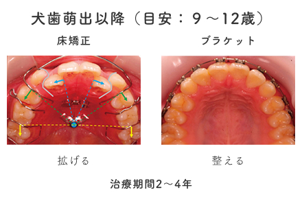 犬歯萌出以降（目安：９〜12歳）