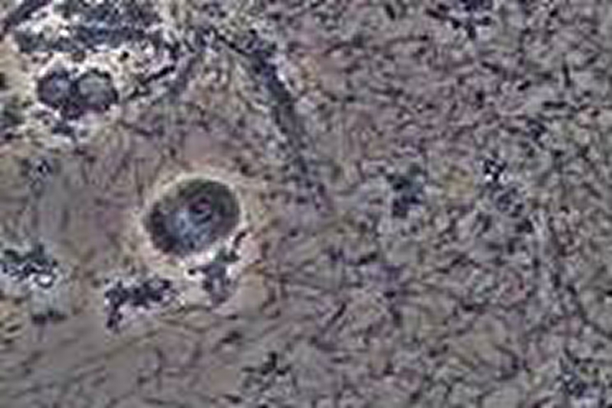 除菌前の顕微鏡画像