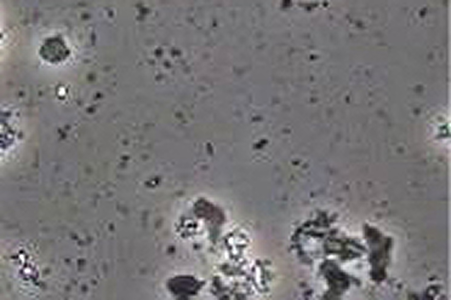 除菌後の顕微鏡画像