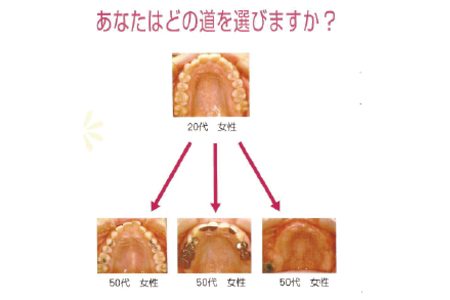 あなたはどの道を選びますか?