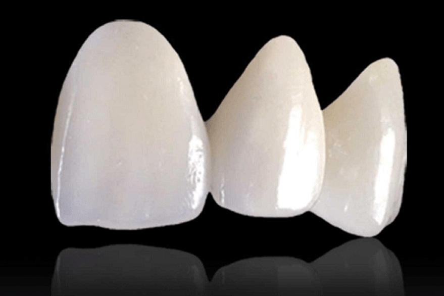 セラミック治療