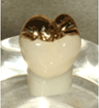 ハイブリットセラミック(セラミック+プラスチック+プラチナゴールド)