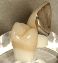 硬質レジン(プラスチック)