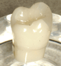 硬質レジン(プラスチック)