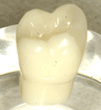 プレスセラミック(セラミックブロック)