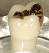 プラチナゴールド