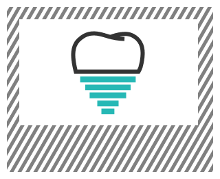 インプラント治療