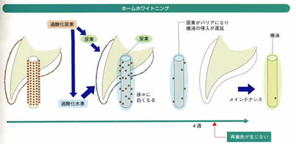 クリニックホワイトニング